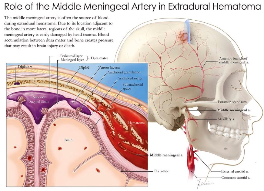 Middle Meningeal Artery Anatomy